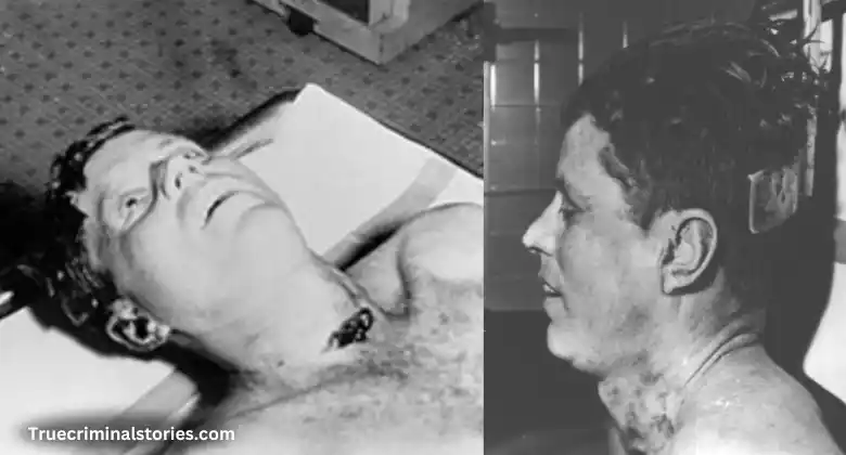 Kennedy Autopsy Photos